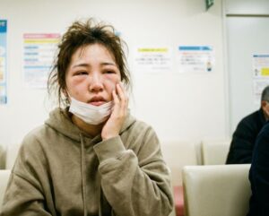 안면 부종의 원인이 되는 전신 질환 신장 및 갑상선 검사